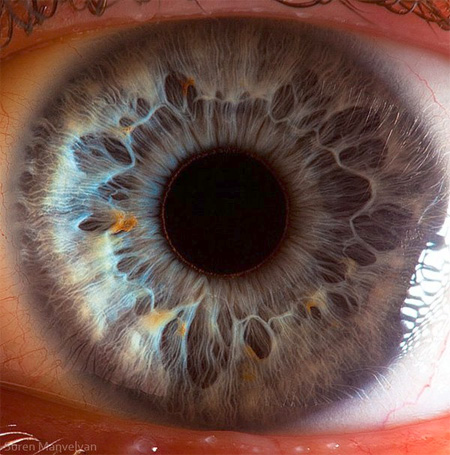 Eye