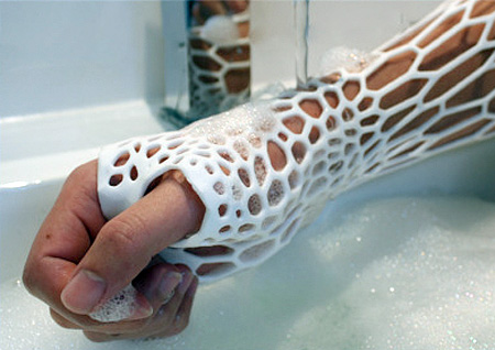 3D Printed Arm Cast