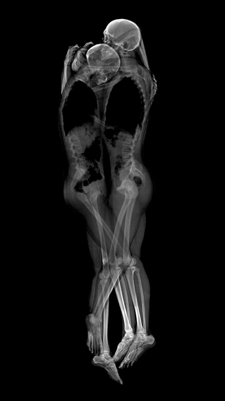 X-Ray Photos of Sleeping Couples