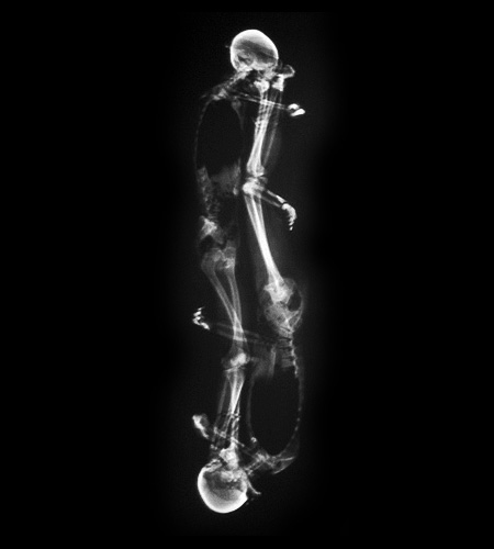 X-Ray Portraits of People