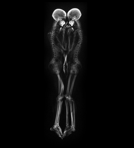 X-Ray Portraits of Couples