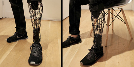 3D Printed Exo Prosthetic Leg