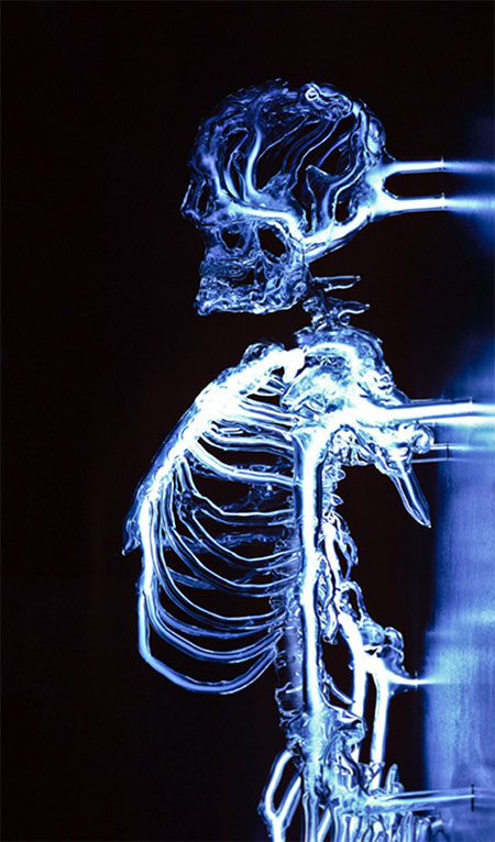 Skeleton Made of Glass