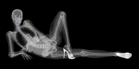 X-Ray Pin-Up Calendar