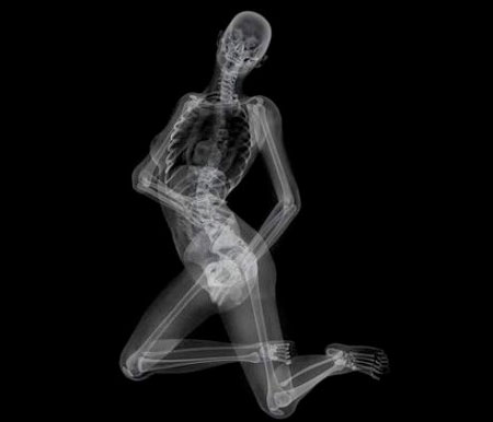 EIZO X-Ray Pin-Up Calendar