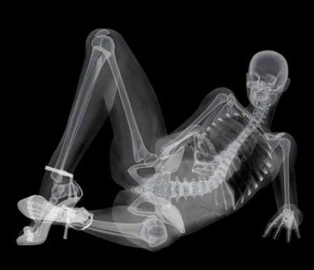 X-Ray Pin-Ups