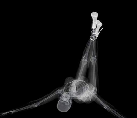 X-Ray Pin-Up