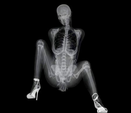 Xray Pinup Calendar