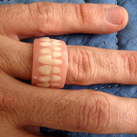 Denture Ring